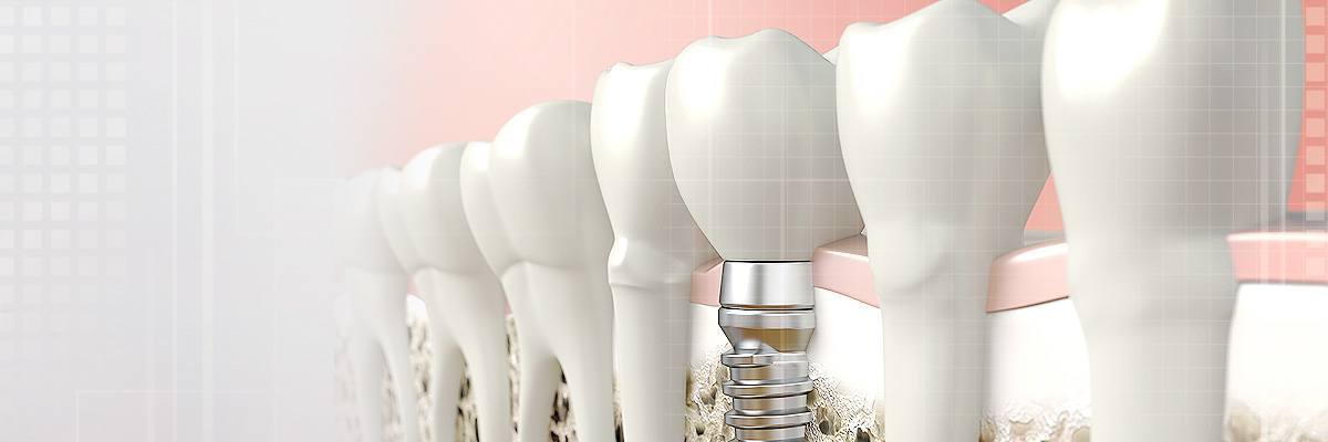 Plano Dental Prosthetics