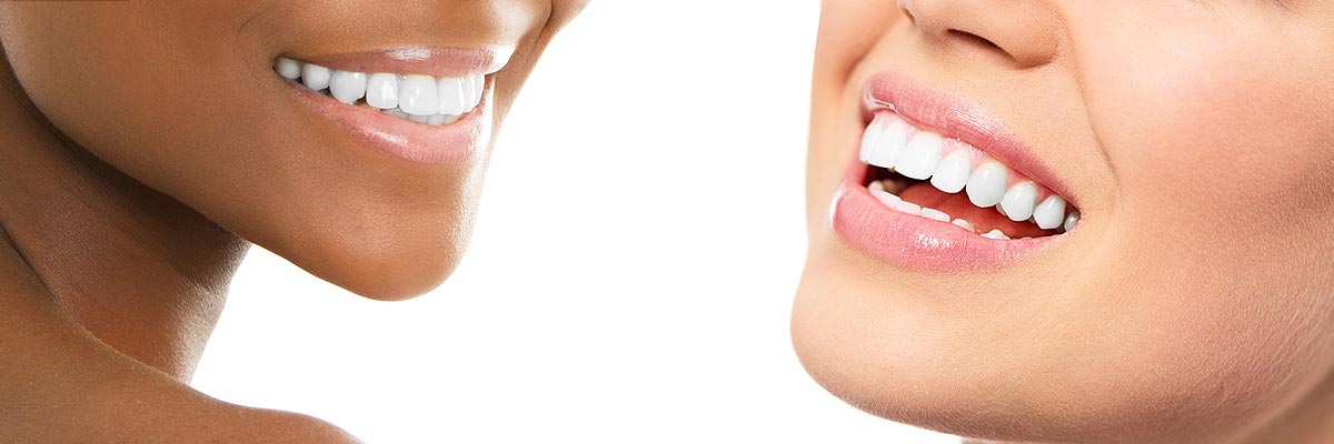 Plano Teeth Whitening