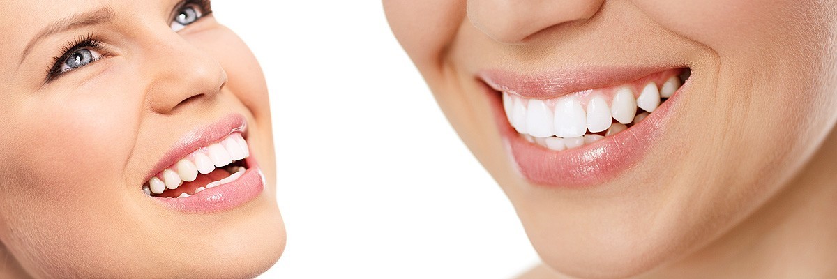 Cosmetic Tooth Bonding Plano TX