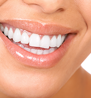 Teeth Whitening Services Plano, TX