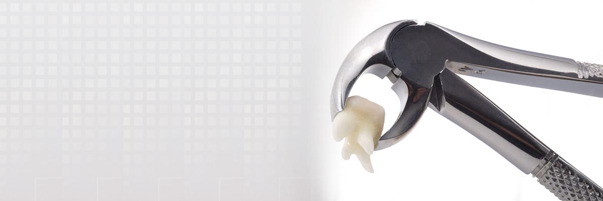 Plano Tooth Extraction